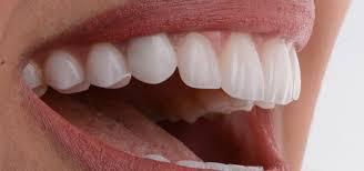 طب الأسنان التجميلي الحديث “ سر الابتسامة المثالية “